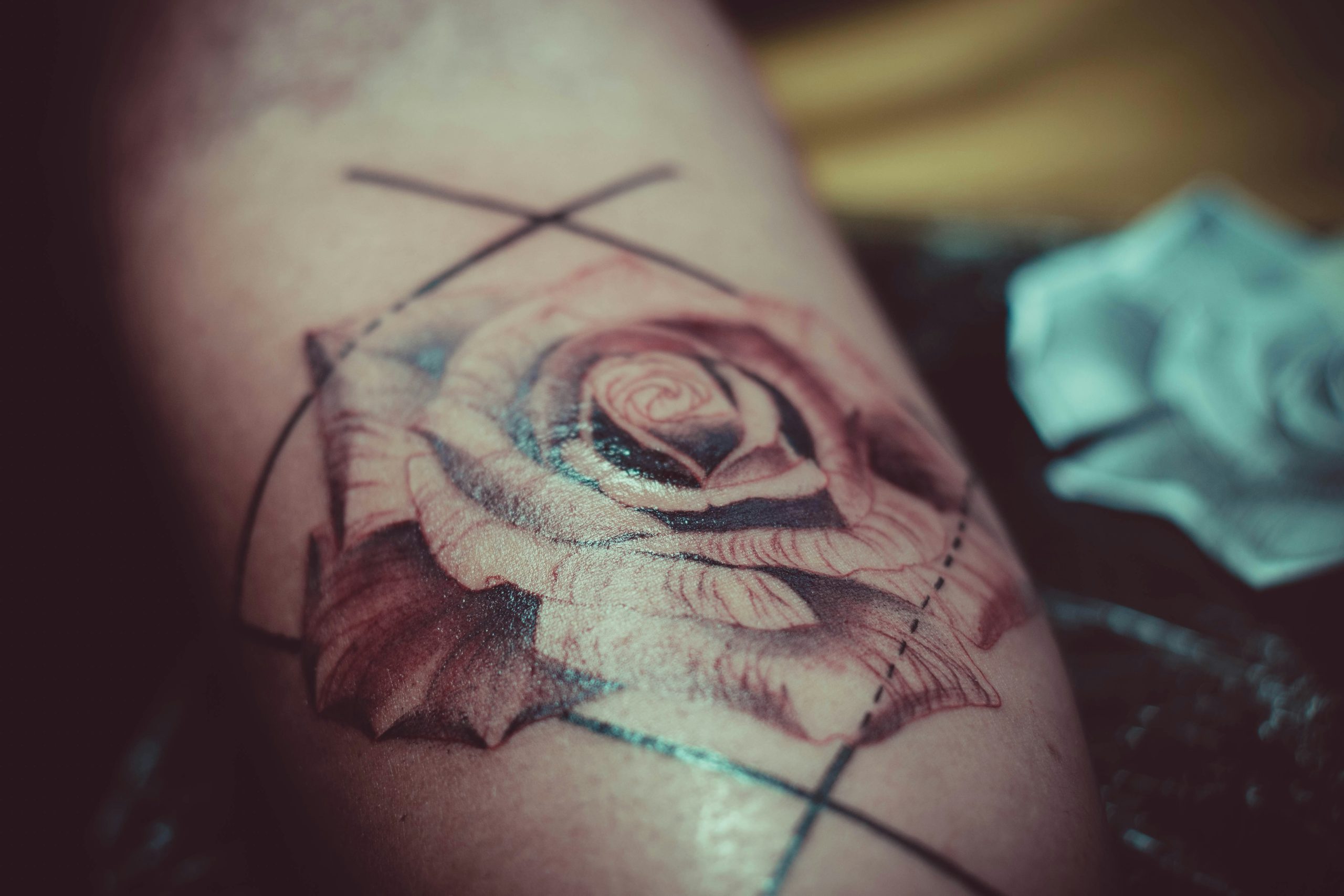 Effective Strategies for Managing Pain and Discomfort During Laser Tattoo Removal