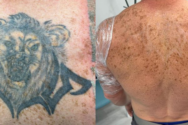 side_by_side-Jasonn-Lion